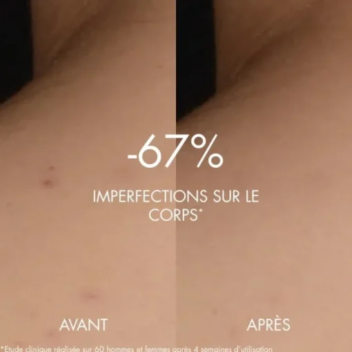 Biotherm Sérum Et Booster|Biocorps                Sérum Anti-Imperfections