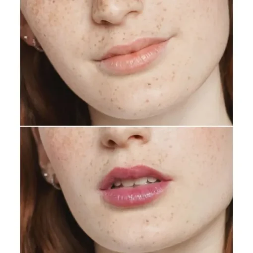 CLINIQUE Baume À Lèvres & Huile À Lèvres|Almost Lipstick™                Baume à Lèvres