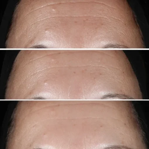 CLINIQUE Sérum Et Booster|Smart Clinical Repair                Sérum Correcteur Anti-Rides