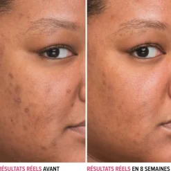 It Cosmetics Soin Spécifique Visage|Sérum Et Booster|Bye Bye Dark Spots                Sérum Anti-taches à la Niacinamide