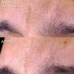 LANCÔME Soin Jour & Nuit|Sérum Et Booster|Rénergie C.R.x. Triple Sérum Rétinol                Sérum Visage