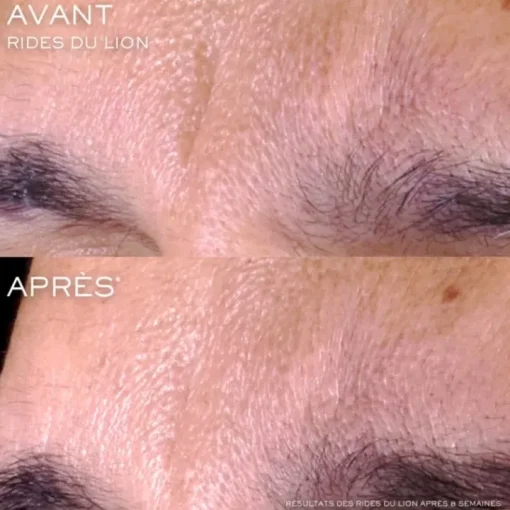 LANCÔME Soin Jour & Nuit|Sérum Et Booster|Rénergie C.R.x. Triple Sérum Rétinol                Sérum Visage